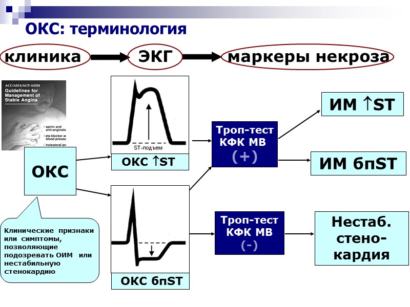 ОКС: терминология ИМ ST ИМ бпST Нестаб. стено-кардия  ОКС  Троп-тест КФК МВ